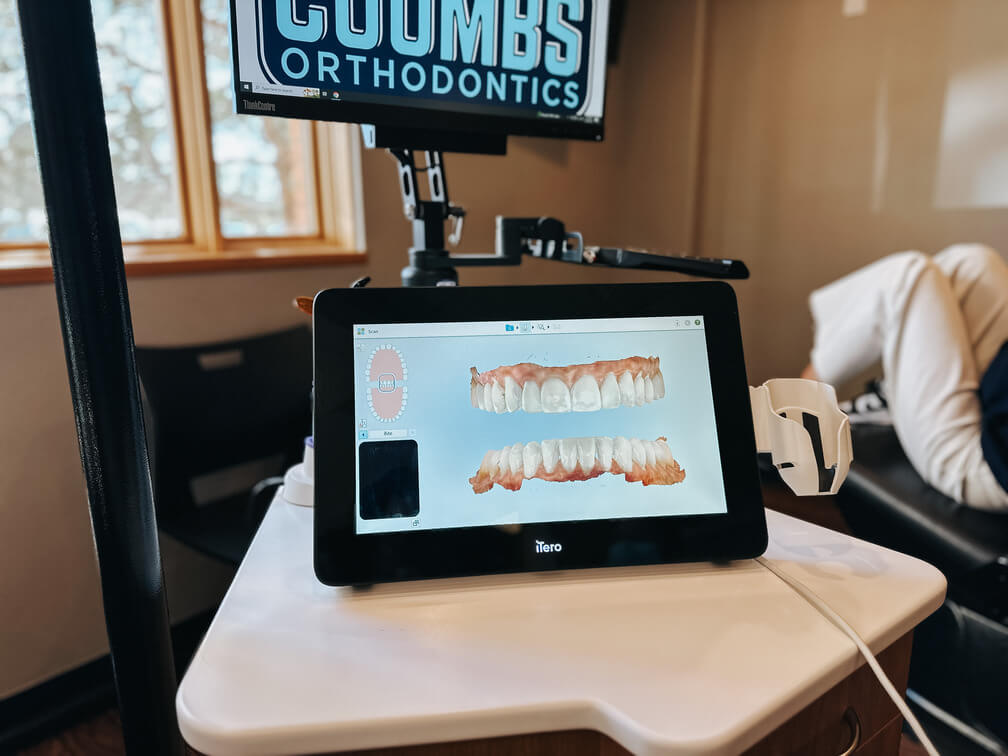 Digital orthodontics in Steamboat Springs CO - Coombs Orthodontics