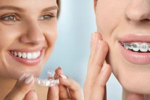 2 smiling women display clear retainers and braces